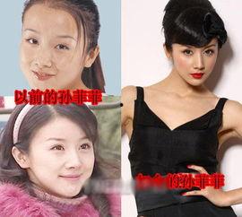 整容天后,揭秘美丽背后的故事与挑战